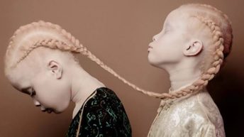 Albino Myths - Afrocrtik