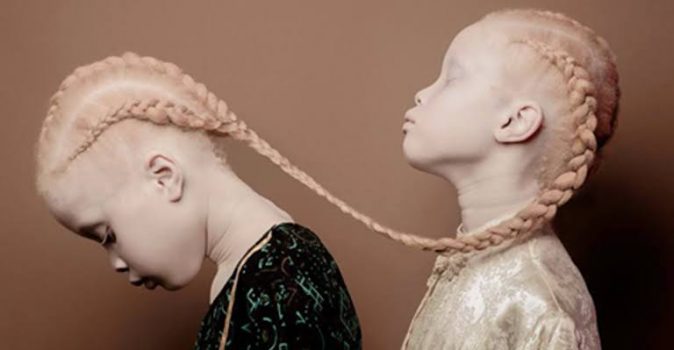 Albino Myths - Afrocrtik