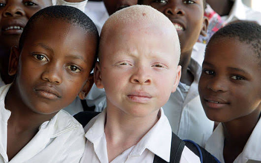 Albino Myths - Afrocritik